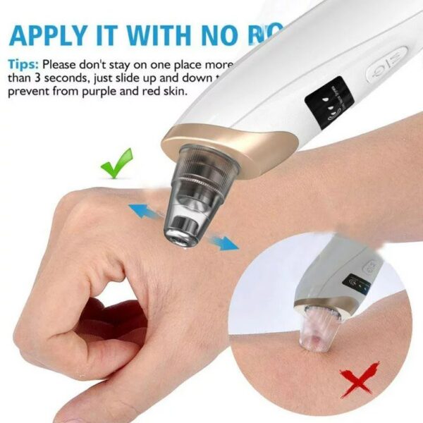 5 in 1 Electric Blackhead Remover Machine Rechargeable - Image 5
