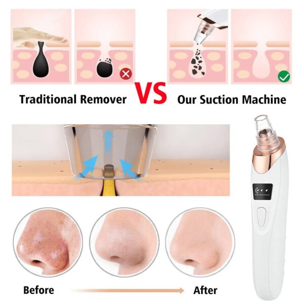 5 in 1 Electric Blackhead Remover Machine Rechargeable - Image 3