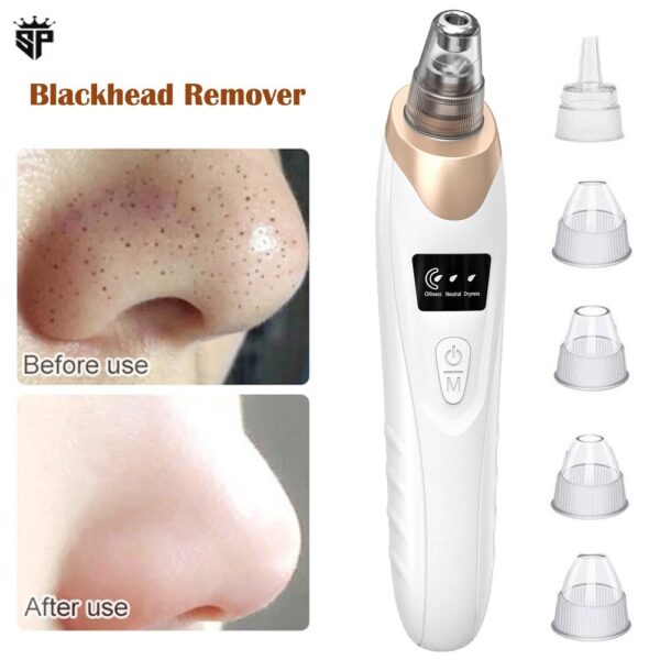 5 in 1 Electric Blackhead Remover Machine Rechargeable - Image 2